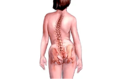 Reasons for the development of cervical osteochondrose