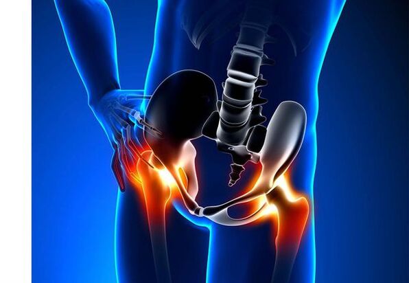 Kokesartroza pain