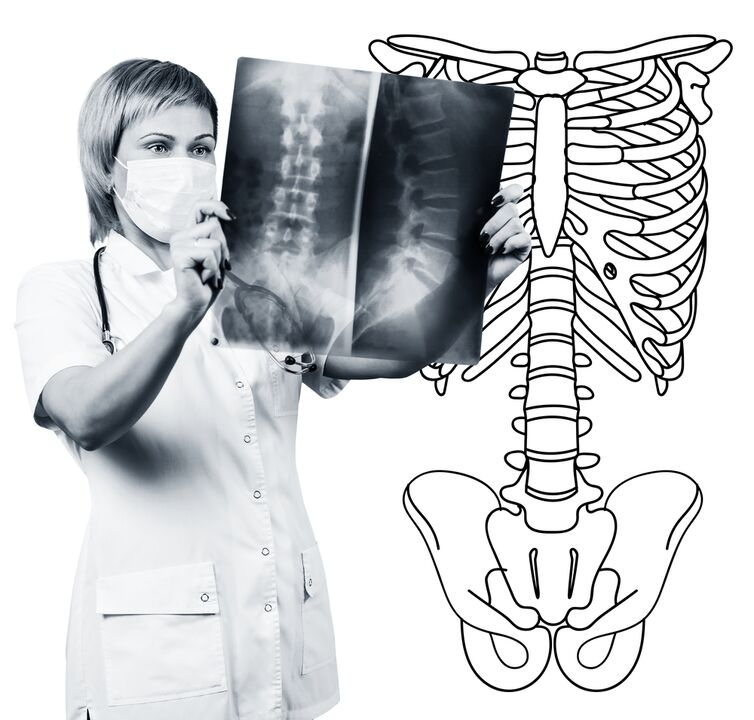 Radography of the lumbar spine